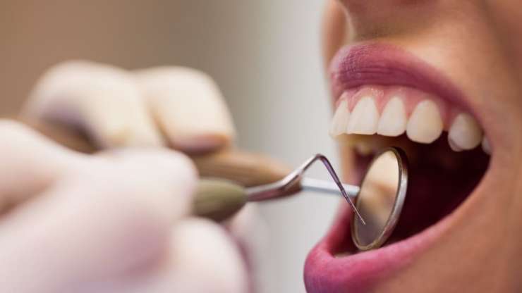 Odontología conservadora : ¿Qué hacer cuándo ya hemos perdido un diente?